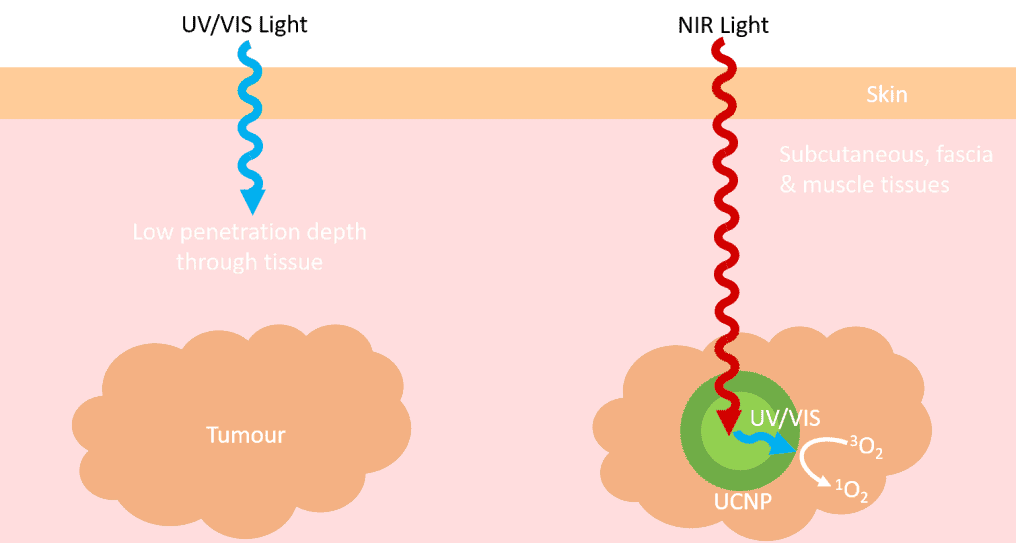 Upconversion photodynamic therapy (UCNP)