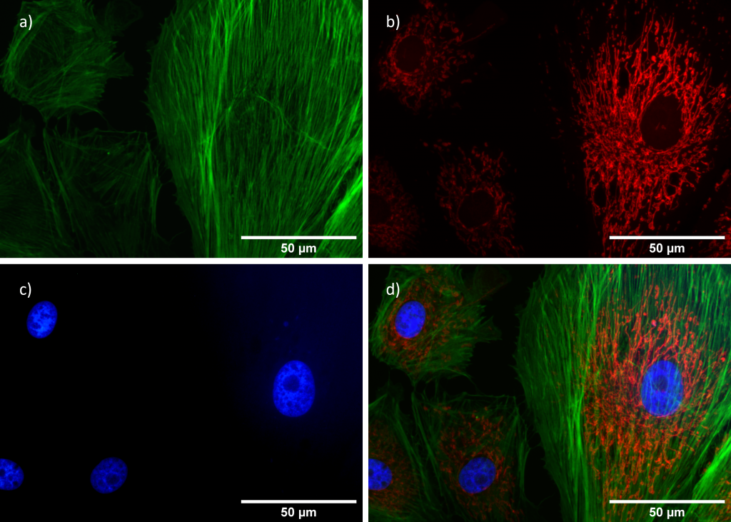 Widefield fluorescence microscope image of bovine pulmonary artery endothelial (BPAE) cells