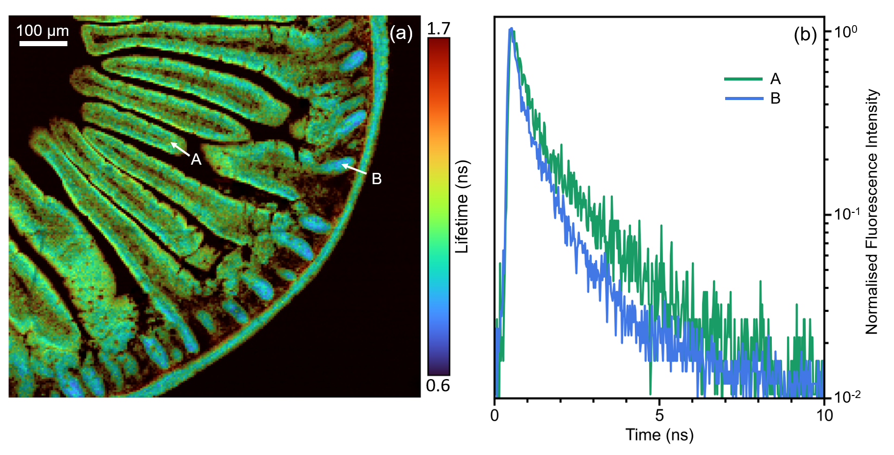 two photon fluorescence lifetime imaging of mouse intestine