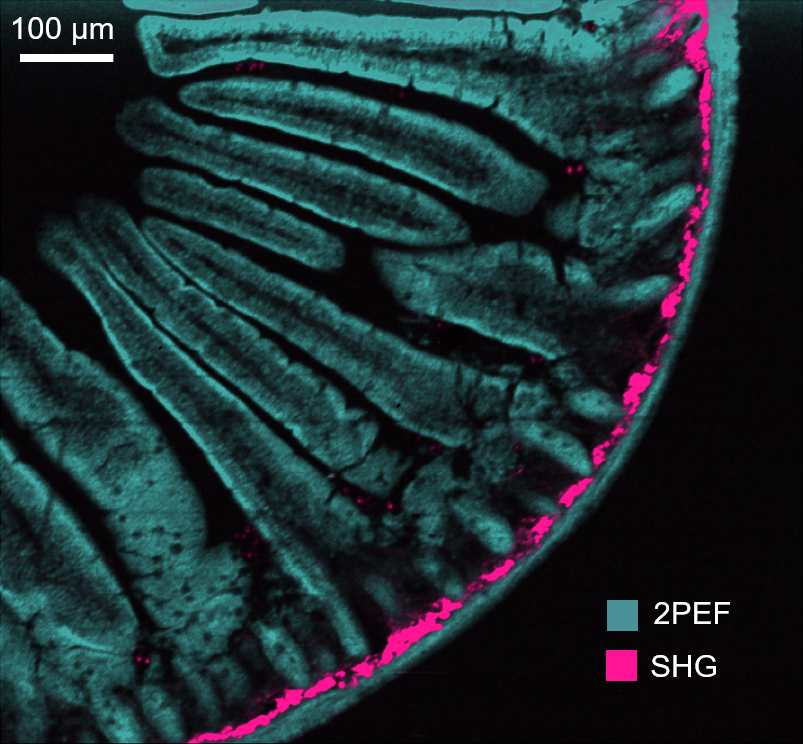 SHG image of mouse intestine