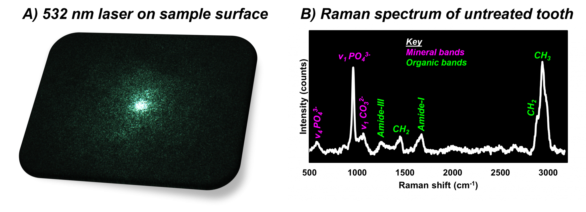 Analysing Bone Composition with Raman Spectroscopy