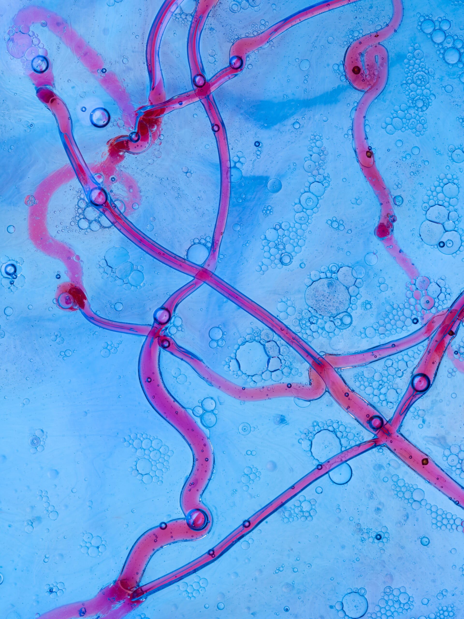 Discrimination of Bacteria Species Using Raman Microscopy and Principal Component Analysis
