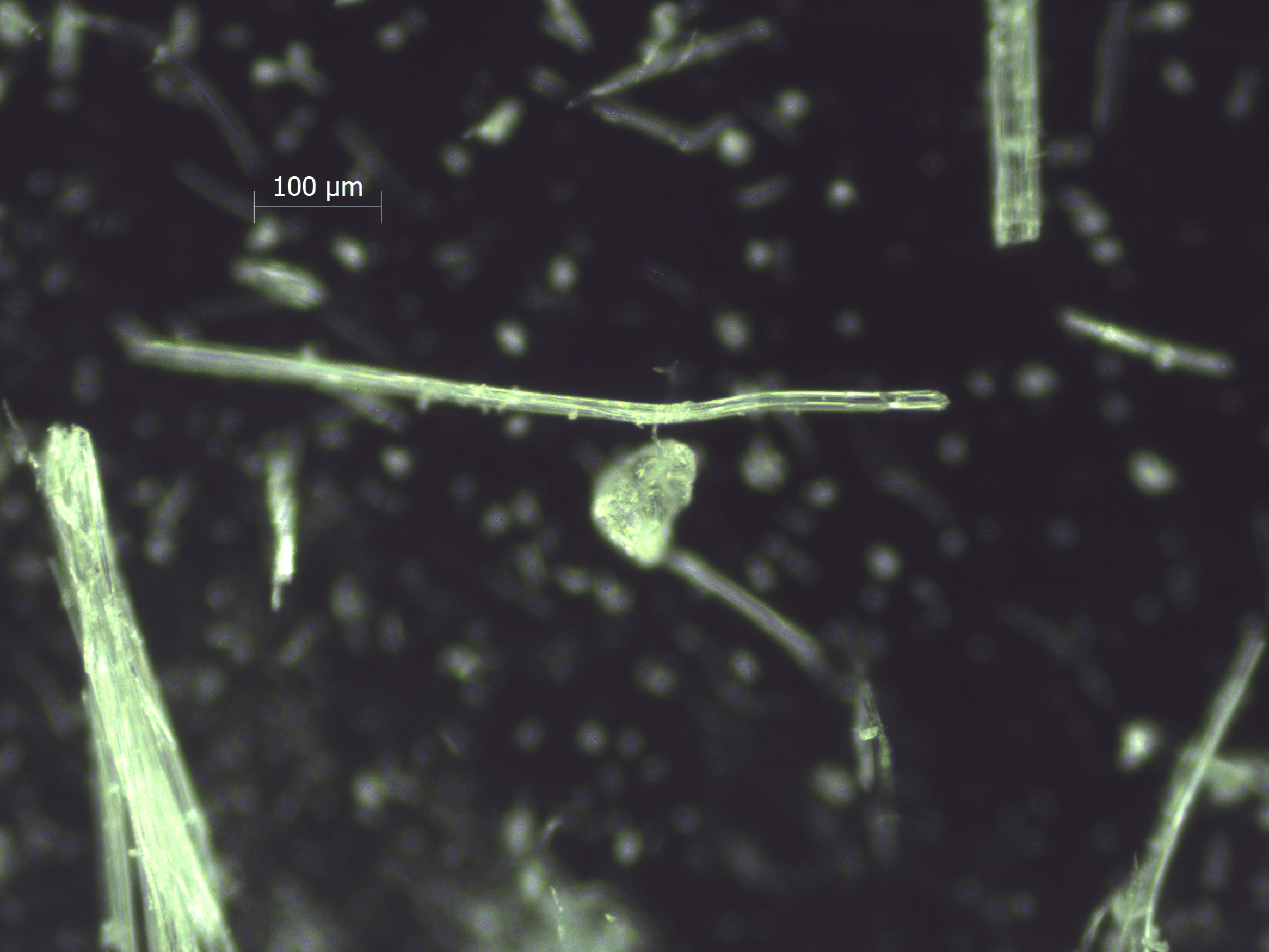 Raman Spectroscopy for Polymorph Identification in Pharmaceuticals