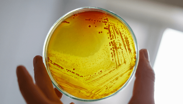 Characterisation of Antimicrobial Photodynamic Therapy Agents Using Photoluminescence and Transient Absorption Spectroscopy